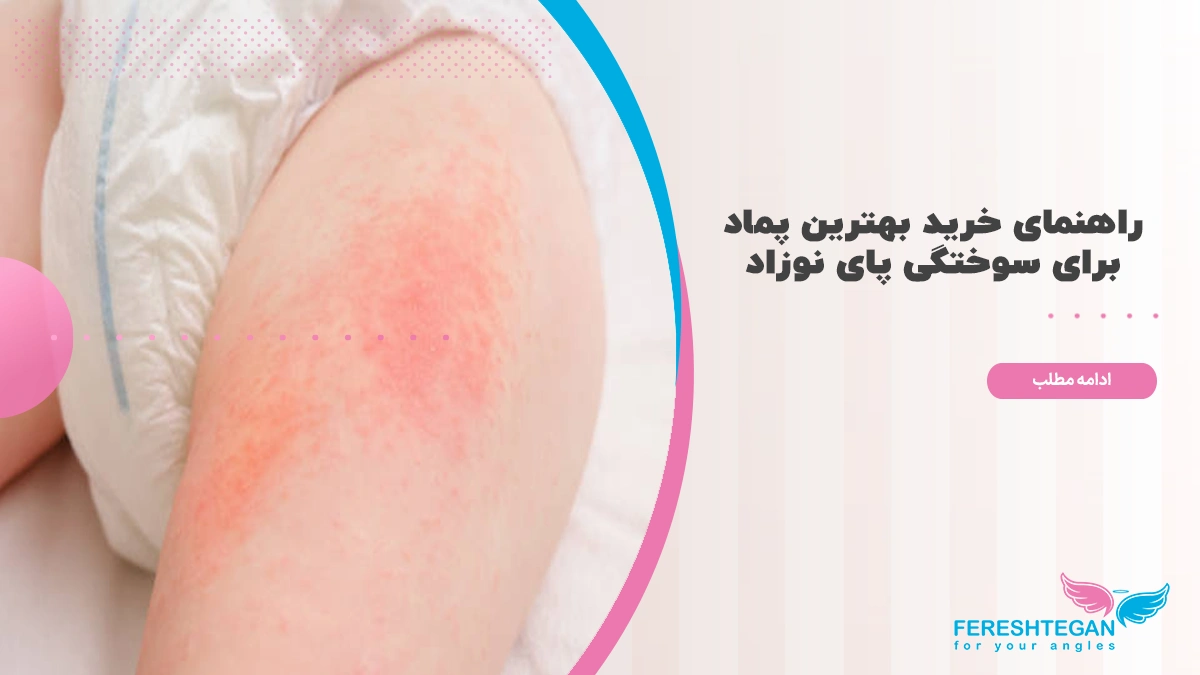 بهترین پماد سوختگی پای نوزاد