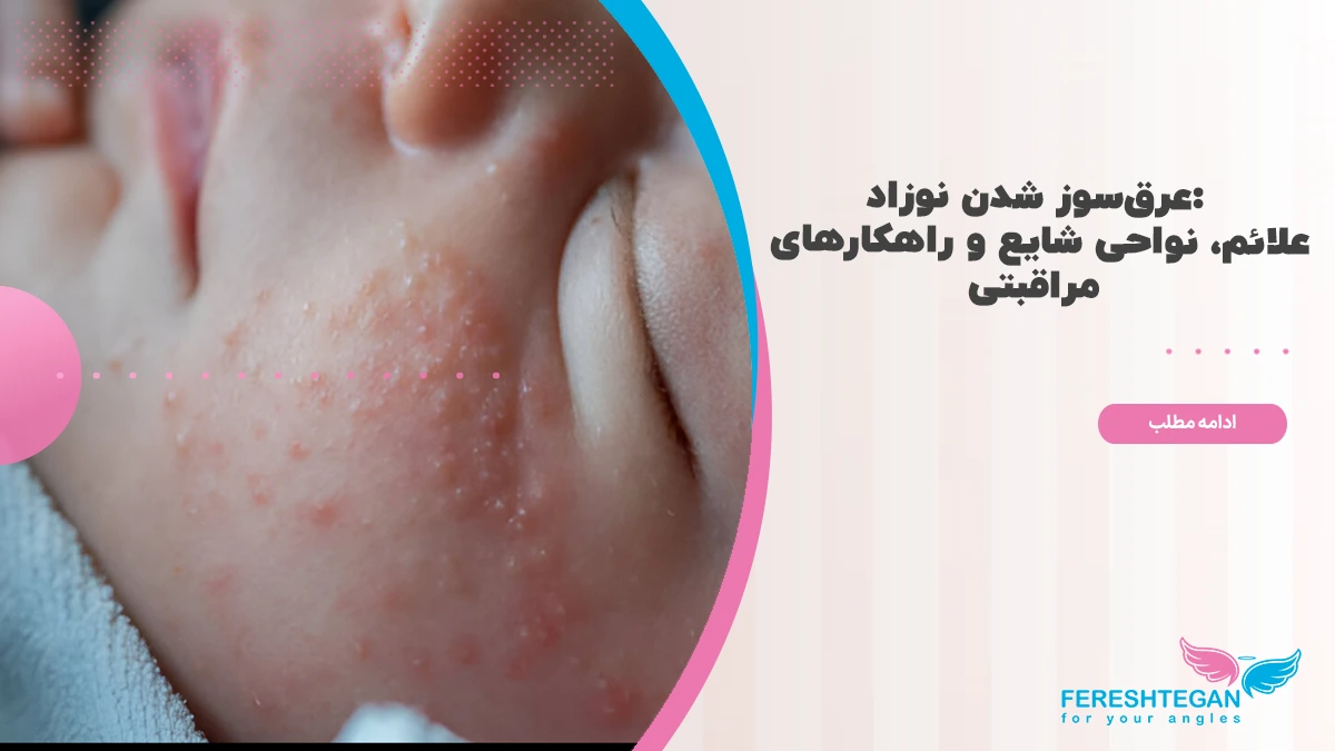 عرق سوز شدن نوزاد