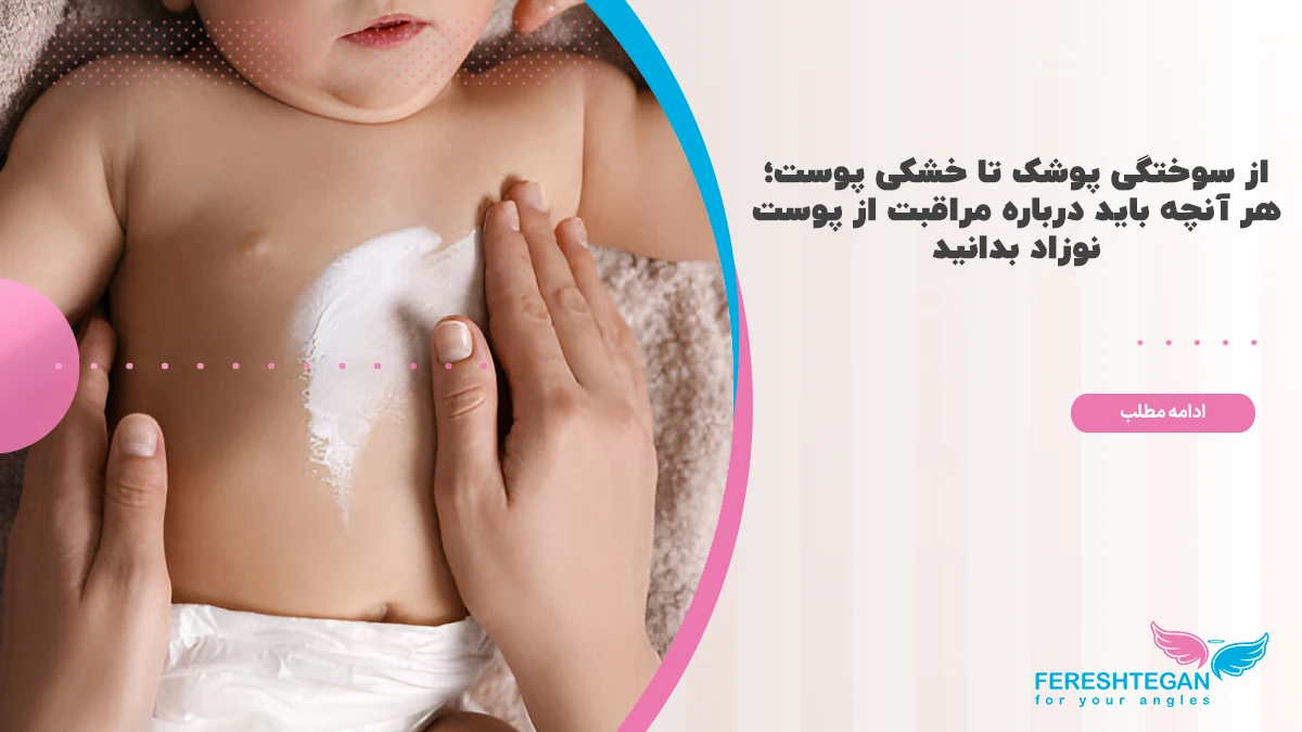 مراقبت از پوست نوزاد