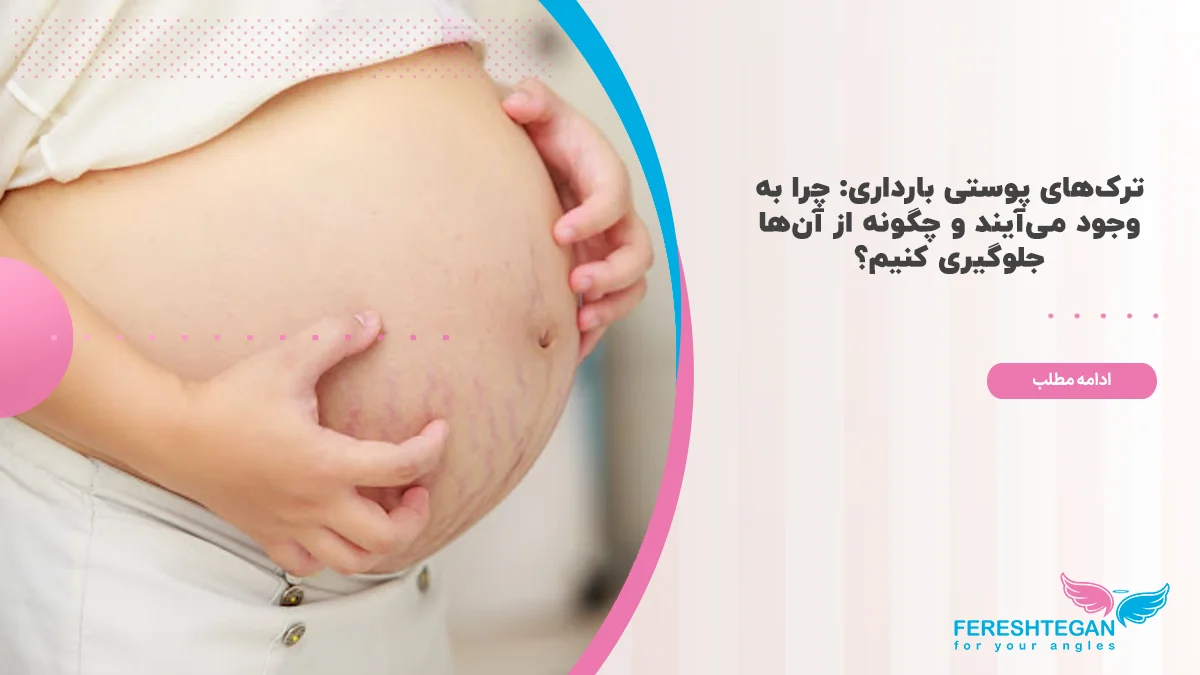 ترک شکم در بارداری