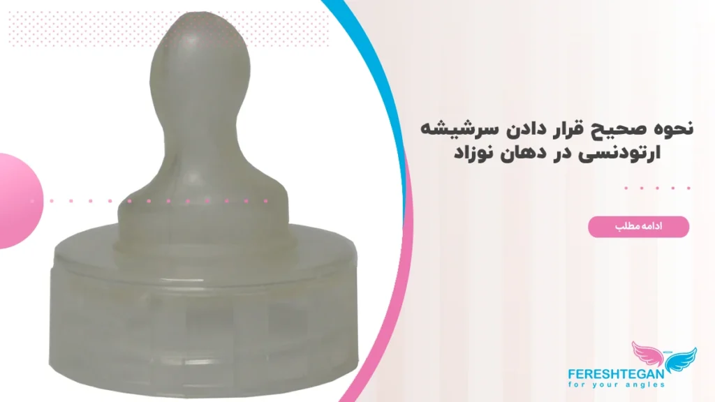 نحوه قرار گرفتن سرشیشه ارتودنسی در دهان نوزاد