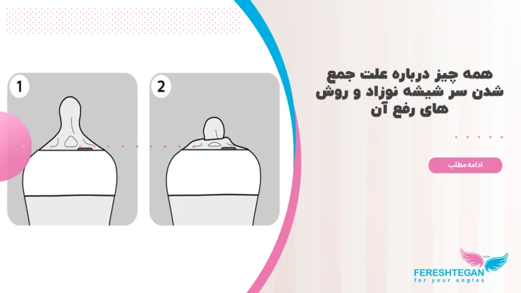 علت جمع شدن سر شیشه نوزاد چیست